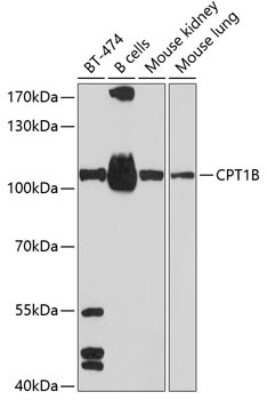 Western Blot: CPT1B AntibodyBSA Free [NBP2-92666]