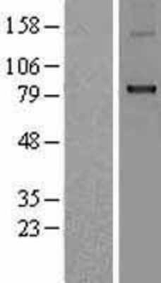 Western Blot: CPT1B Overexpression Lysate [NBP2-09999]