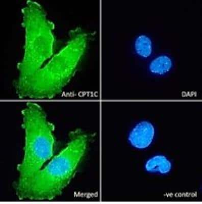 Immunocytochemistry/ Immunofluorescence: CPT1C Antibody [NBP1-44064]