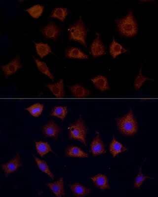 Immunocytochemistry/ Immunofluorescence: CPT1C Antibody - Azide and BSA Free [NBP2-92133]