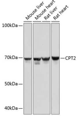 Western Blot: CPT2 Antibody (9V6M9) [NBP3-15294]