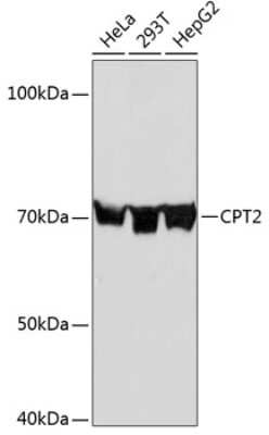 Western Blot: CPT2 Antibody (9V6M9) [NBP3-15294]