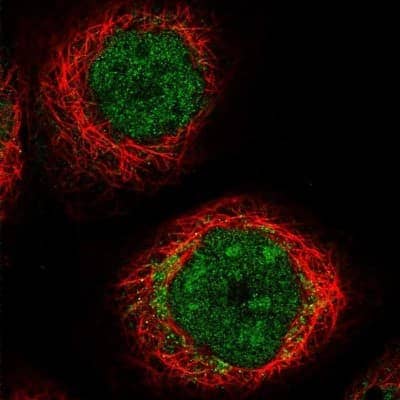 Immunocytochemistry/ Immunofluorescence: CPT2 Antibody [NBP1-85471]