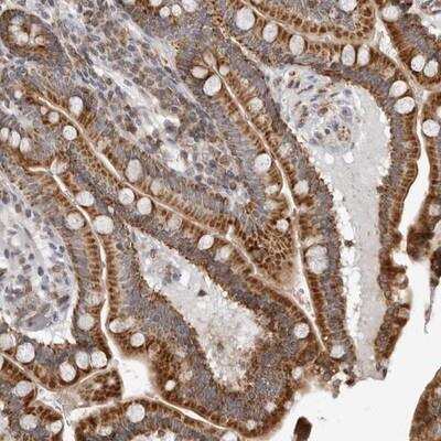 Immunohistochemistry-Paraffin: CPT2 Antibody [NBP1-85470]