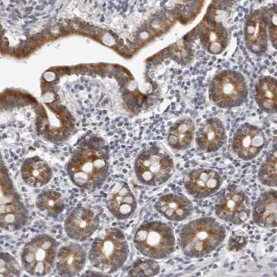 Immunohistochemistry-Paraffin: CPT2 Antibody [NBP1-85471]