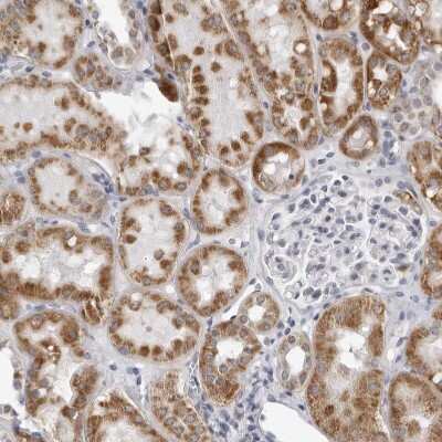 Immunohistochemistry-Paraffin: CPT2 Antibody [NBP1-85471]