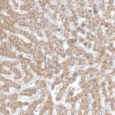 Immunohistochemistry-Paraffin: CPT2 Antibody [NBP1-85471]