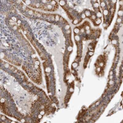 Immunohistochemistry-Paraffin: CPT2 Antibody [NBP1-85472]