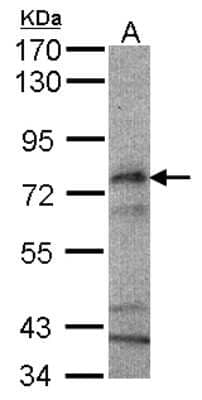 Western Blot: CPT2 Antibody [NBP1-32226]