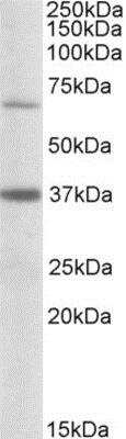 Western Blot: CPT2 Antibody [NBP1-46137]