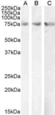 Western Blot: CPT2 Antibody [NBP1-51993]