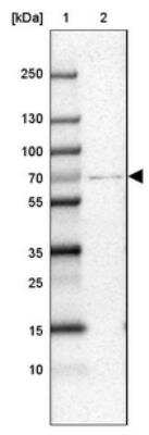 Western Blot: CPT2 Antibody [NBP1-85470]