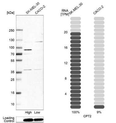 Western Blot: CPT2 Antibody [NBP1-85472]