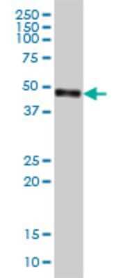 Western Blot: CPVL Antibody (2G5-1C1) [H00054504-M01]