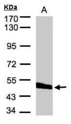 Western Blot: CPVL Antibody [NBP1-32428]