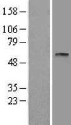 Western Blot: CPVL Overexpression Lysate [NBL1-09452]