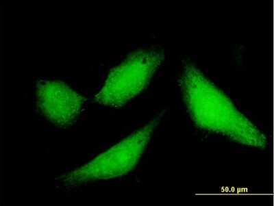 Immunocytochemistry/ Immunofluorescence: CPXCR1 Antibody [H00053336-B01P]