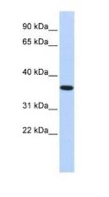 Western Blot: CPXCR1 Antibody [NBP1-80386]