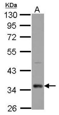 Western Blot: CPXCR1 Antibody [NBP2-15995]