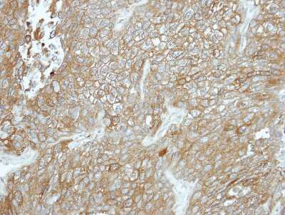 Immunohistochemistry-Paraffin: Carboxypeptidase X1/CPXM1 Antibody [NBP2-15996]