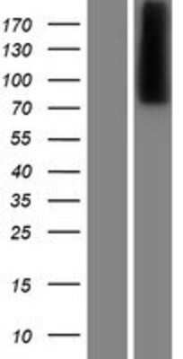 Western Blot: Carboxypeptidase X1/CPXM1 Overexpression Lysate [NBP2-06715]