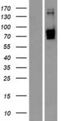 Western Blot: Carboxypeptidase X1/CPXM1 Overexpression Lysate [NBP2-11459]