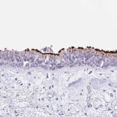 Immunohistochemistry-Paraffin: CPXM2 Antibody [NBP2-13869]