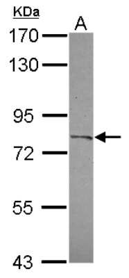 Western Blot: CPXM2 Antibody [NBP2-15997]