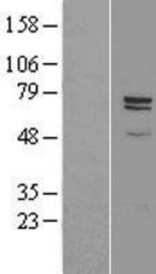 Western Blot: CPZ Overexpression Lysate [NBL1-09456]