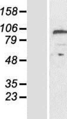 Western Blot: CPZ Overexpression Lysate [NBP2-08739]