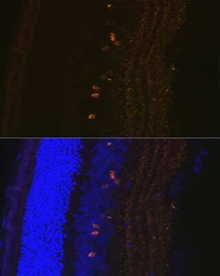 Immunohistochemistry: CRABP1 Antibody (7N4F3) [NBP3-16601]