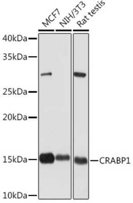 Western Blot: CRABP1 Antibody (7N4F3) [NBP3-16601]