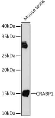 Western Blot: CRABP1 Antibody (7N4F3) [NBP3-16601]