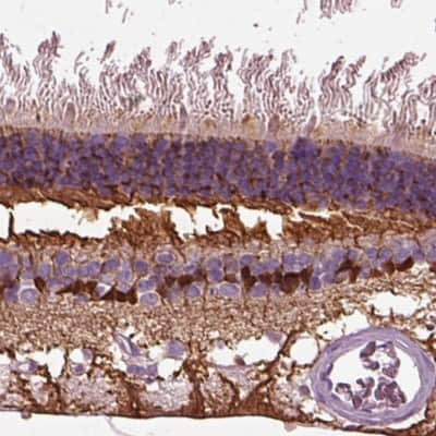 Immunohistochemistry-Paraffin: CRABP1 Antibody [NBP1-84384]