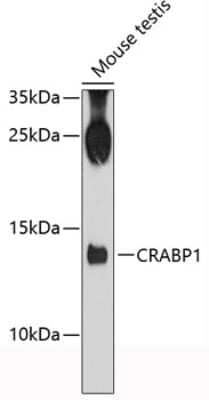 Western Blot: CRABP1 AntibodyAzide and BSA Free [NBP2-92084]