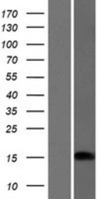 Western Blot: CRABP1 Overexpression Lysate [NBP2-07877]