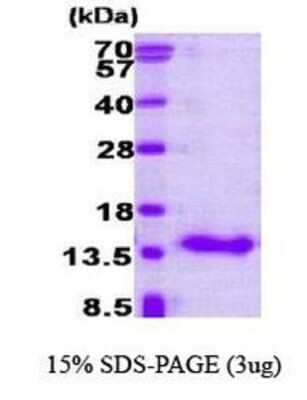 SDS-PAGE: Recombinant Human CRABP1 Protein [NBP1-30183]