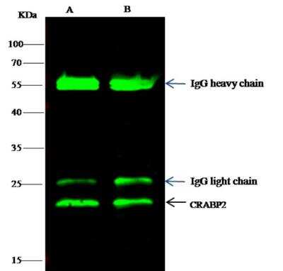 Immunoprecipitation: CRABP2 Antibody (004) [NBP2-89836]