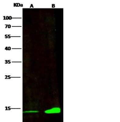 Western Blot: CRABP2 Antibody (004) [NBP2-89836]