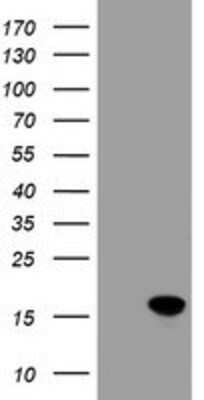 Western Blot: CRABP2 Antibody (OTI10D6) [NBP2-03807]