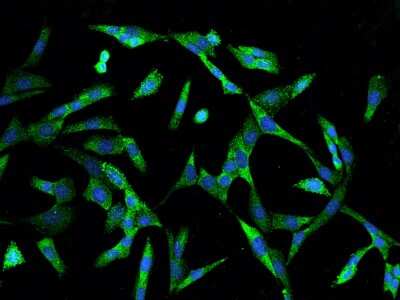 Immunocytochemistry/ Immunofluorescence: CRABP2 Antibody [NBP2-98294]