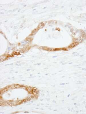 Immunohistochemistry-Paraffin: CRABP2 Antibody [NB100-2590]