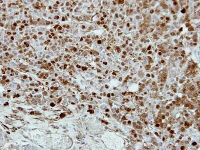 Immunohistochemistry-Paraffin: CRABP2 Antibody [NBP2-15998]