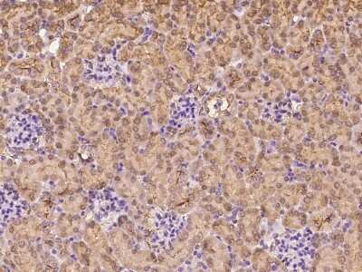 Immunohistochemistry-Paraffin: CRABP2 Antibody [NBP2-98294]
