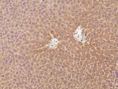 Immunohistochemistry-Paraffin: CRABP2 Antibody [NBP2-98294]