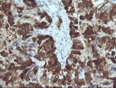 Immunohistochemistry: CRABP2 Antibody (OTI10D6) - Azide and BSA Free [NBP2-70448]