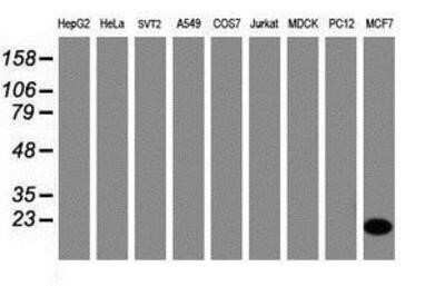 Western Blot: CRABP2 Antibody (OTI10D6)Azide and BSA Free [NBP2-70448]