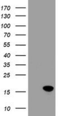 Western Blot: CRABP2 Antibody (OTI10D6)Azide and BSA Free [NBP2-70448]