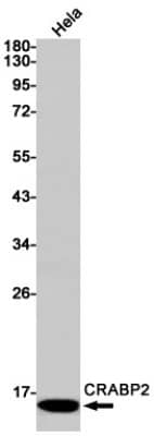 Western Blot: CRABP2 Antibody (S01-4C4) [NBP3-19505]