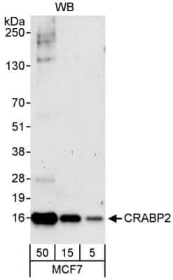 Western Blot: CRABP2 Antibody [NB100-2590]